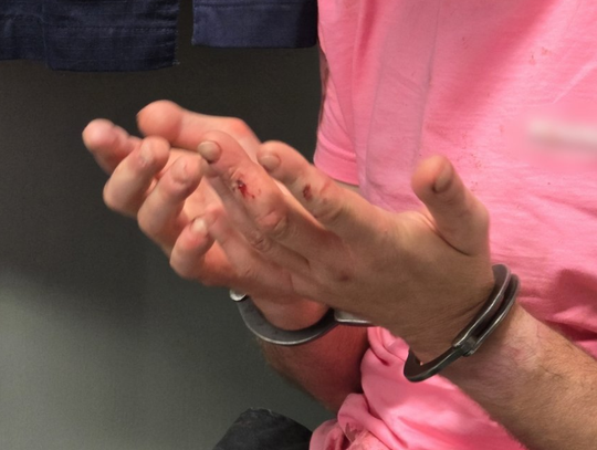 Poszedł do dentysty i ukradł mu portfel. Potem schował się w piwnicy przed policjantami