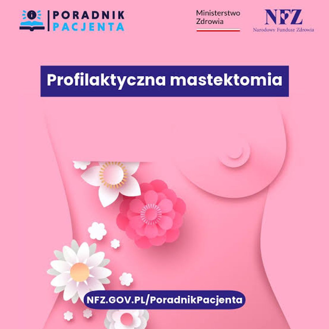 Profilaktyczna mastektomia na NFZ. Kiedy warto rozważyć zabieg? Profilaktyczna mastektomia na NFZ. Kiedy warto rozważyć zabieg?